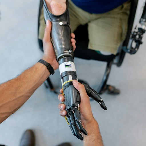 Оцінка системи надання послуг військовим та цивільним з ампутаціями